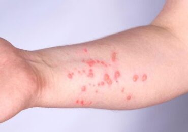 Imbauan Penting Bagi Masyarakat yang Masuk ke Samarinda untuk Lapor Mandiri ke 119